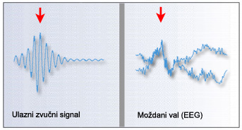 Pojava moždanog vala nakon djelovanja zvučnog signala